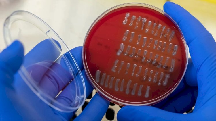 مراكز مكافحة الأمراض تُحذّر من الأطعمة الملوثة