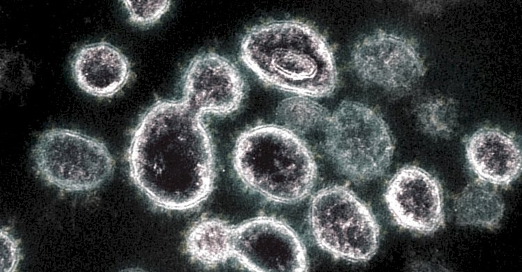 ظهور أول إصابة بسلالة شديدة التحور من أوميكرون في كندا