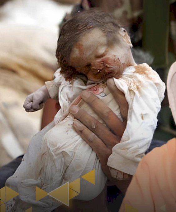 هذه هي مباديء الصهاينة قتل المرضي العزل وقصف المستشفيات