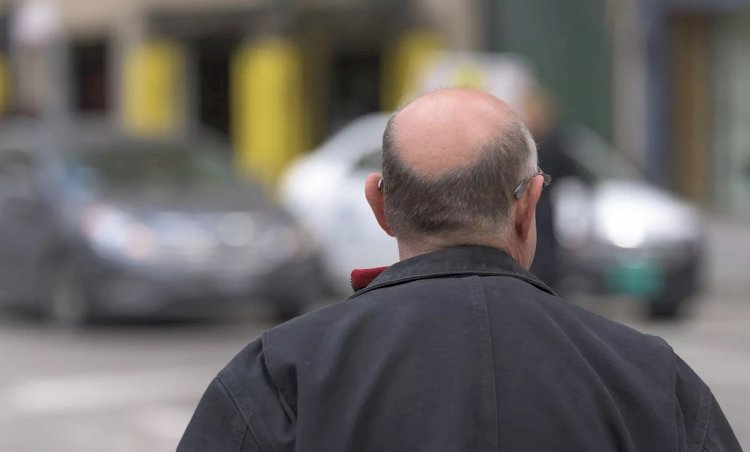 اكتشاف بروتين جديد يحميك من تساقط الشعر وينشط الخلايا الجذعية