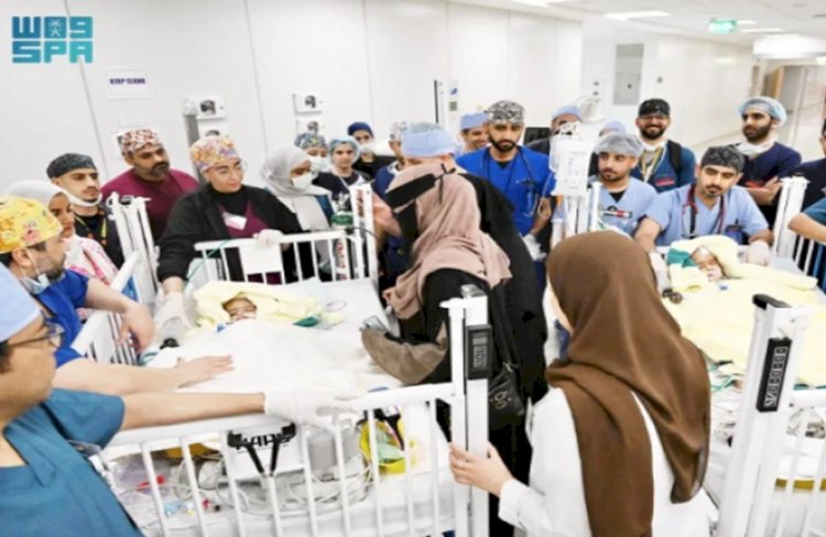 36 إستشاري ينجحون في فصل توأنم إريتيري بعد جراحة استمرت 15 ساعة ونصف