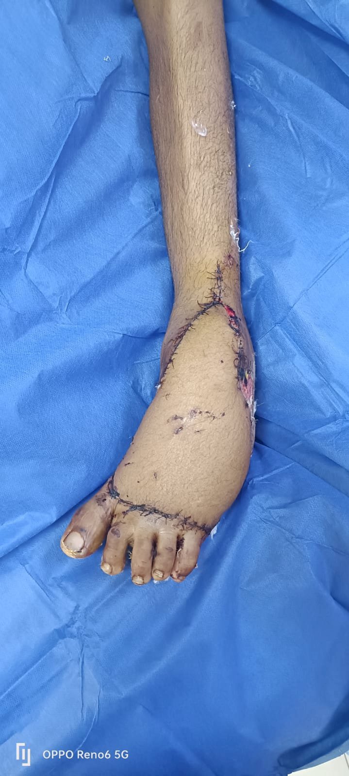 انجاز  وملحمة جديدة  لقسم جراحه التجميل بمستشفى حورس