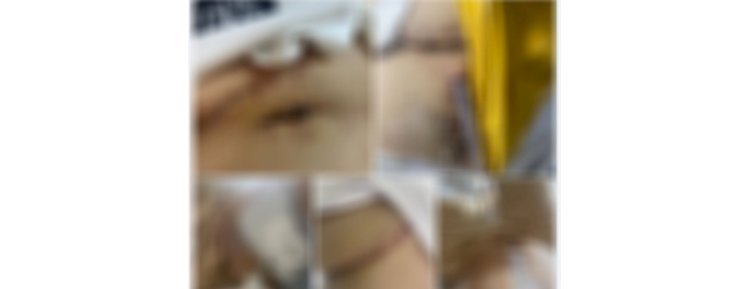 نكشف فيديو قيام عدد من الأشخاص بالتعدى على آخر بالضرب بإستخدام أسلحة بالبحيرة