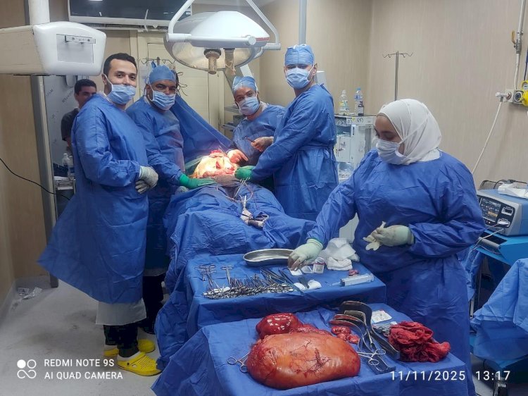 نجاح فريق طبي بمستشفيات جامعة بني سويف باستئصال ورم ضخم يصل وزنه ٢٢ كيلو