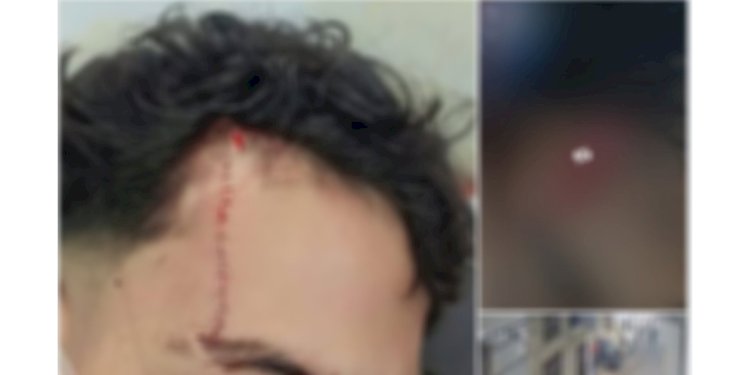 القبض علي طالب لقيامه بضرب عامل بمطواه بسبب المزاح بالدقهلية