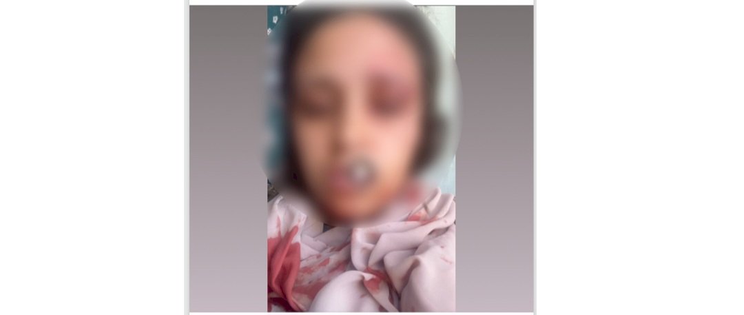 ضبط عامل لقيامه بالتعدى بالضرب علي زوجة شقيقه لخلافات عائلية بالشرقية