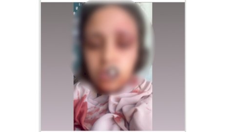 ضبط عامل لقيامه بالتعدى بالضرب علي زوجة شقيقه لخلافات عائلية بالشرقية